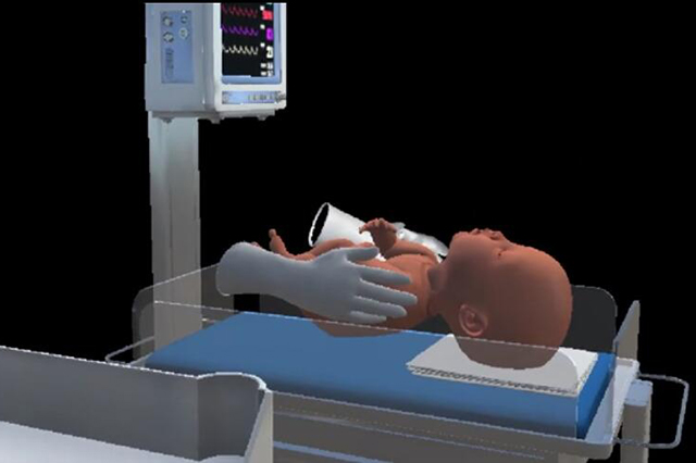 MR模拟固尔苏在治疗新生儿ARDS中的给药操作